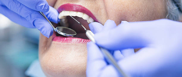 Best Emergency Dental Services for Seniors in Monterey, CA