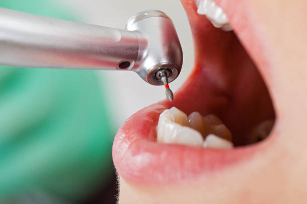 Best Holiday Emergency Dentist in Monterey, CA